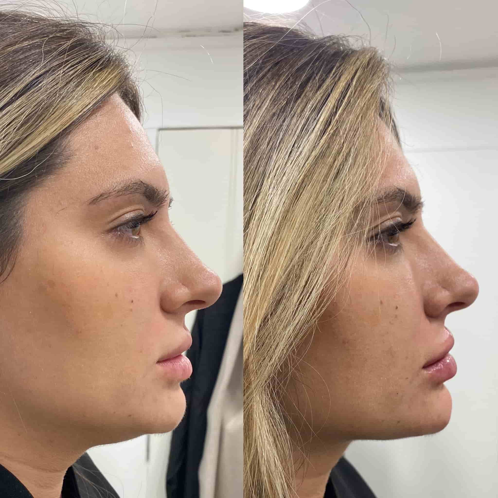 Facial Aesthetics Swindon Dentalcare