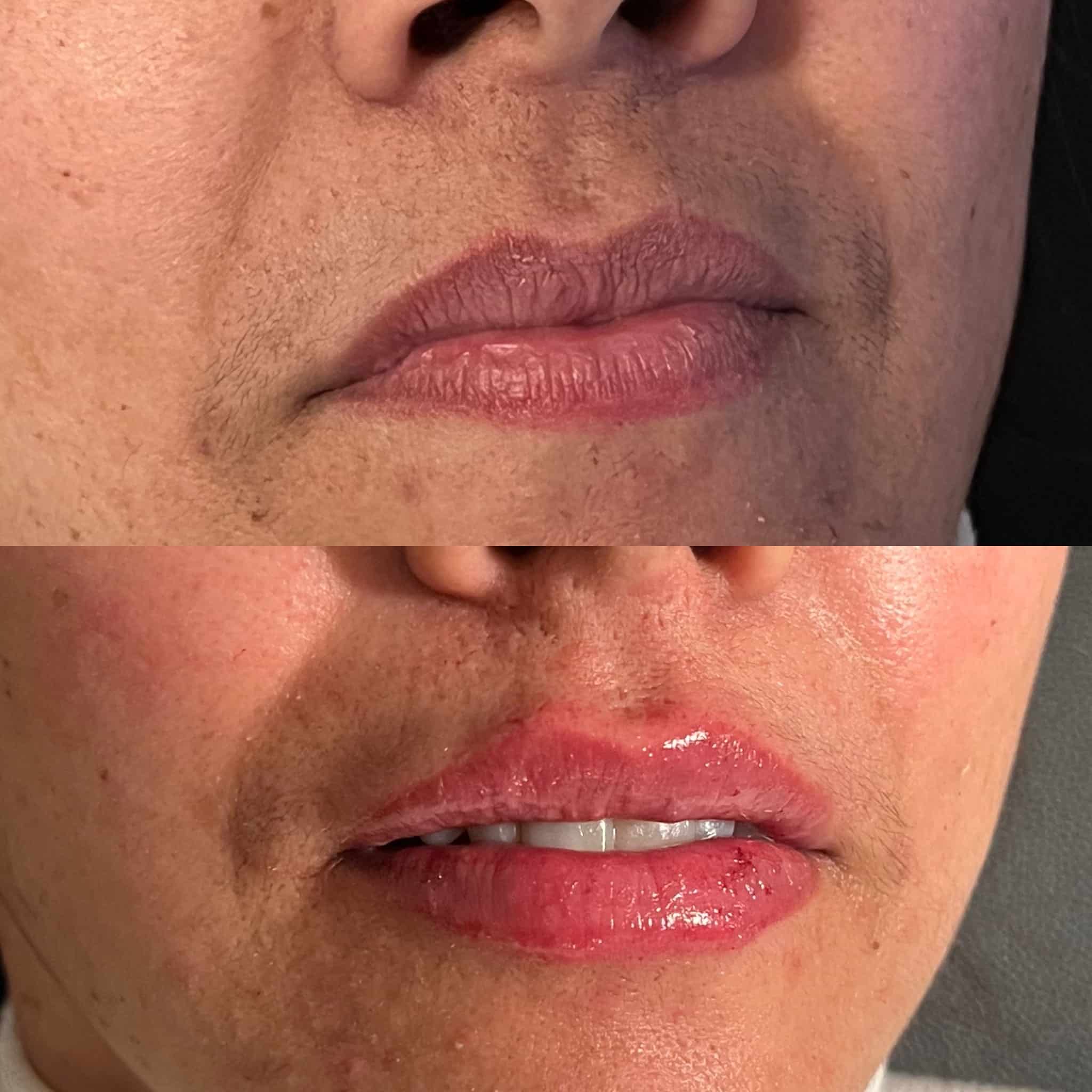 Facial Aesthetics Swindon Dentalcare